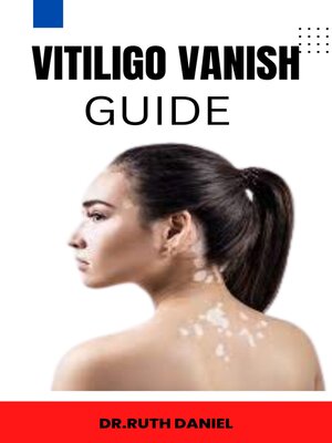 cover image of The Vitiligo Vanish Guide